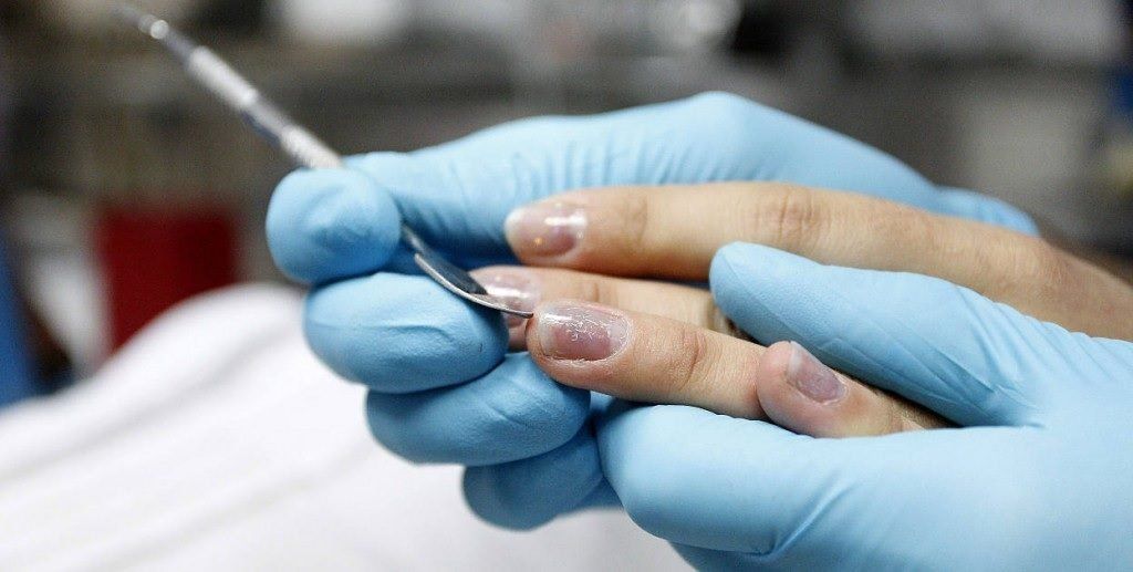 qué es la tanatopraxia