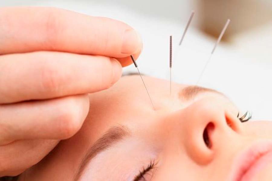 master en acupuntura