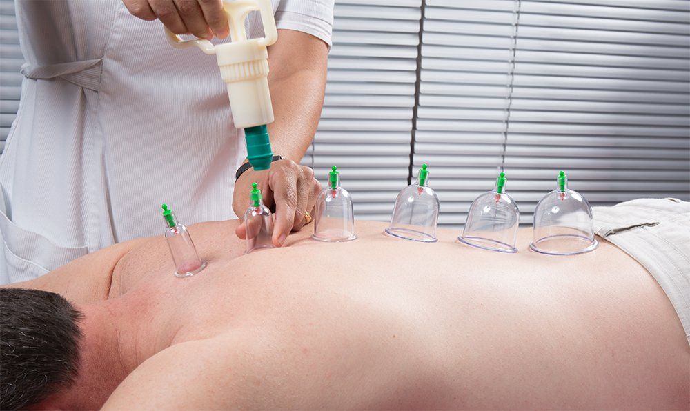qué es el cupping