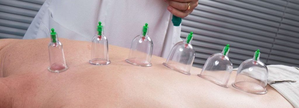 Cursos especializado en masaje cupping